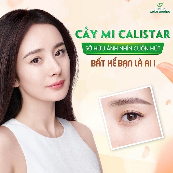 Cấy mi sinh học ở đâu đẹp và an toàn?