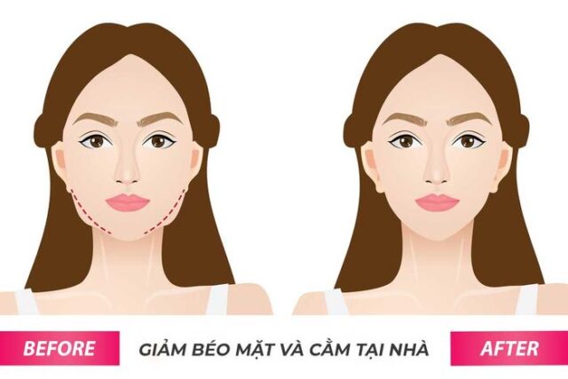 130. 2 cach giam mo mat hieu qua Triệt mỡ mặt 2