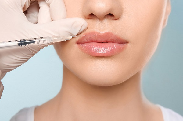 Tiêm filler môi tự nhiên gợi cảm