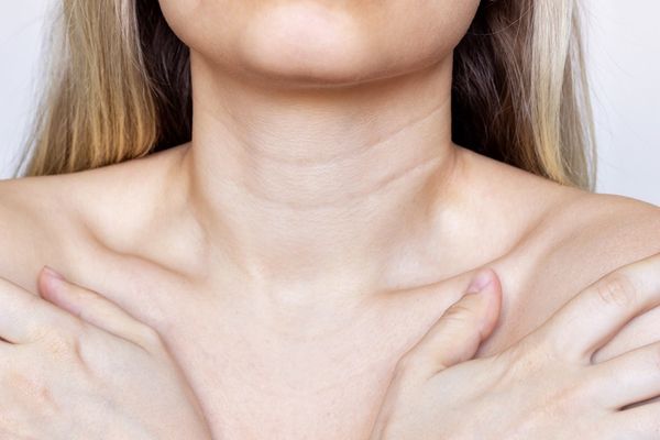 21 Da co bi chung nhao 5 Da cổ bị chùng nhão 5