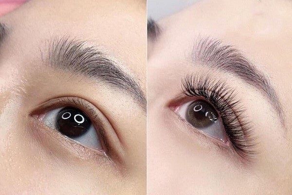 cấy lông mi sinh học4