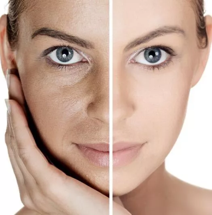 xóa nhăn tuổi trung niên