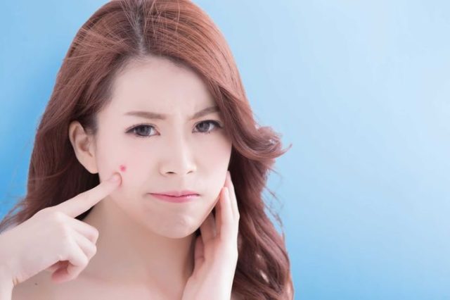Trị mụn dứt điểm tại Xuân Trường cùng hệ thống máy móc tân tiến
