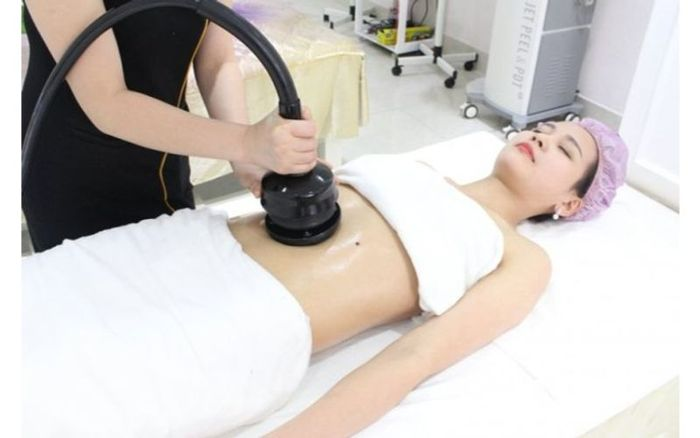 Triệt mỡ bụng tại TPHCM 4