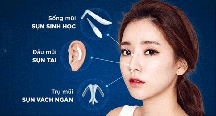 nang mui s line danh cho nam 2 Nâng mũi S Line dành cho Nam 3