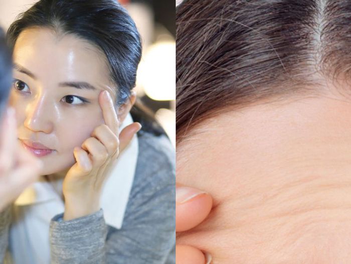 cách xóa vết nhăn trên trán 4