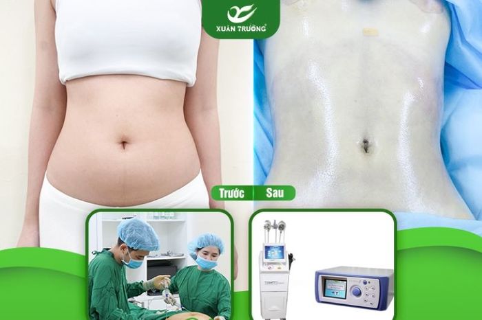 cách giảm mỡ 3