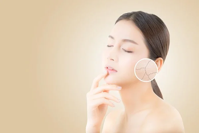 116 Tri seo ro 2 Trị sẹo rỗ 2
