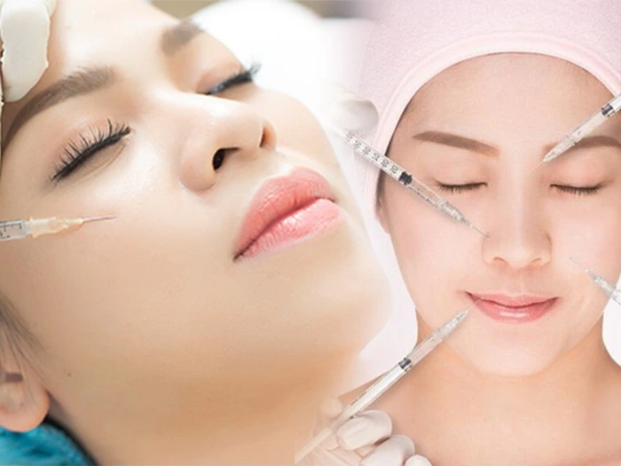 119 Nhung luu y sau khi tiem filler 1 Những lưu ý sau khi tiêm filler 1