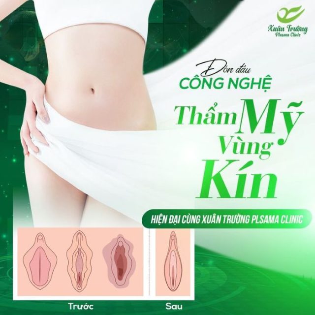 học thẩm mỹ vùng kín ở đâu 3