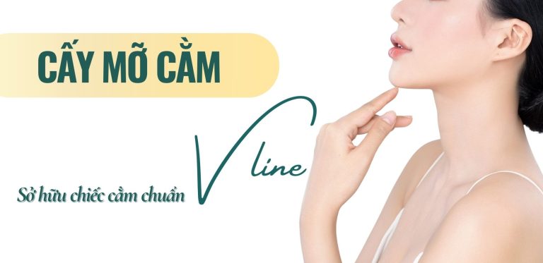 Cay mo cam