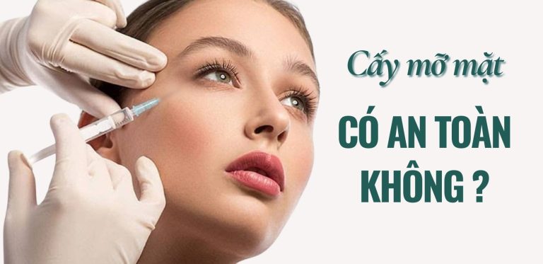 Cay mo mat co an toan khong