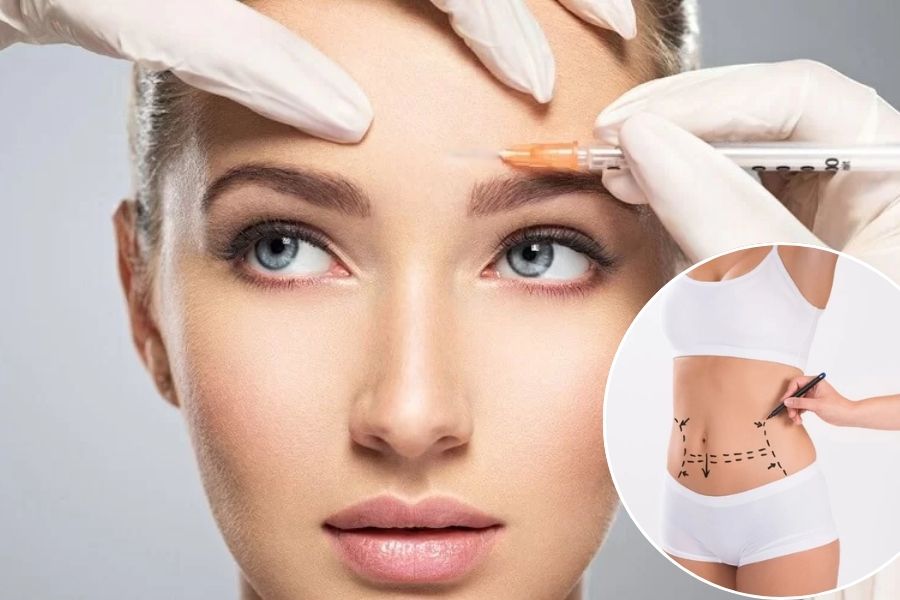 Cay mo tran su dung mo mo tu than tu co the de cay len vung tran