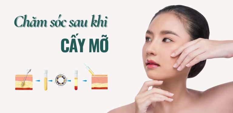 Cham soc sau khi cay mo