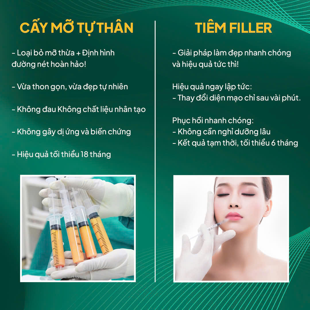 So sanh cay mo tu than va tiem filler