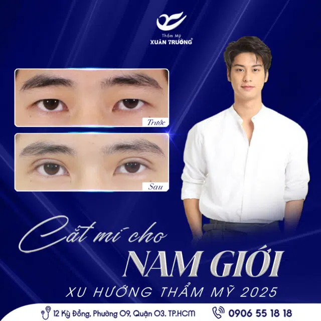 cat mi cho nam xu huong tham my 2025