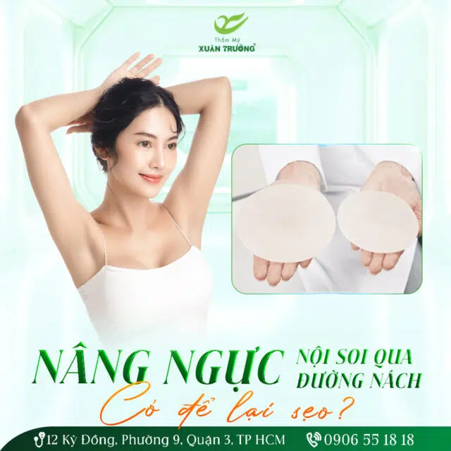 Nang nguc noi soi qua duong nach co de lai seo