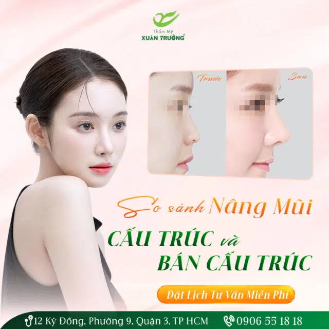 So sanh nang mui cau truc va ban cau truc 2025