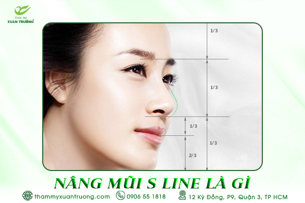 Nâng Mũi S Line Là Gì? - Phương Pháp Nâng Mũi Hiện Đại
