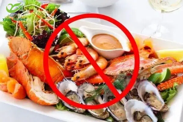 Kiêng hải sản giúp vết thương nhấn mí nhanh lành, không để sẹo