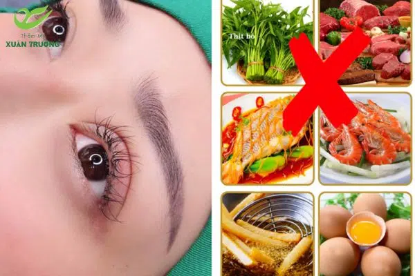 Thời gian hồi phục nhanh hay chậm phụ thuộc vào chế độ kiêng ăn