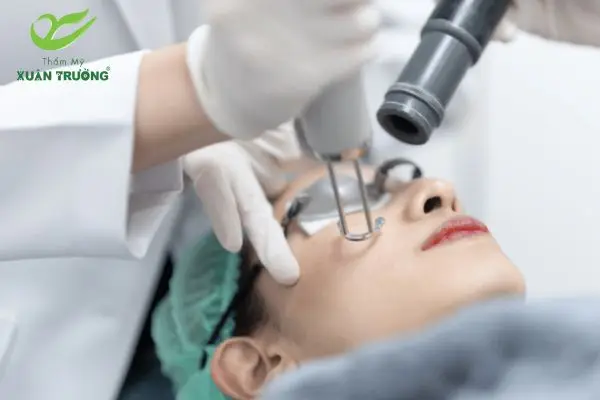 cong nghe tri nam laser toning 4 Cận cảnh quy trình chiếu Laser Toning tại Thẩm Mỹ Xuân Trường
