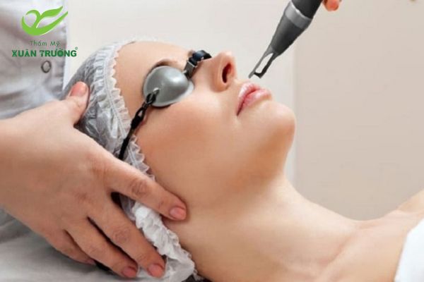 Công nghệ laser trị môi thâm bẩm sinh được nhiều người lựa chọn
