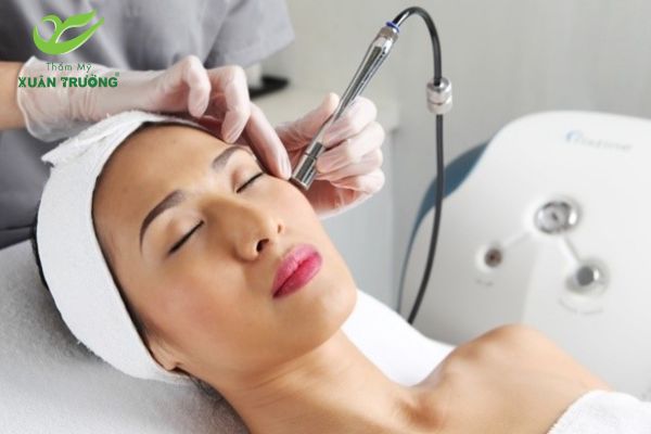 Điều trị mụn bằng công nghệ laser tại spa