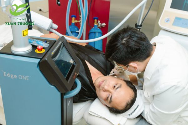 Máy laser CO2 Fractional đang hoạt động trong quá trình điều trị da mụn
