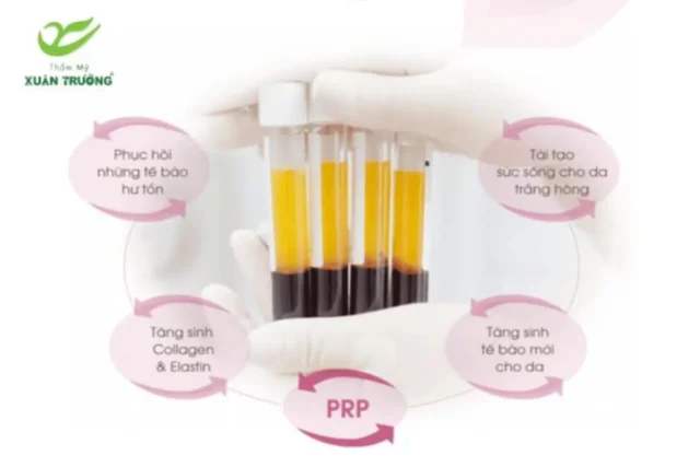 cay PRP 1 Huyết tương giàu tiểu cầu giúp tái tạo và trẻ hóa làn da