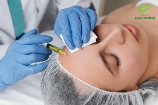 cay PRP 2 Quy trình cấy PRP gồm lấy máu, ly tâm và tiêm vào da