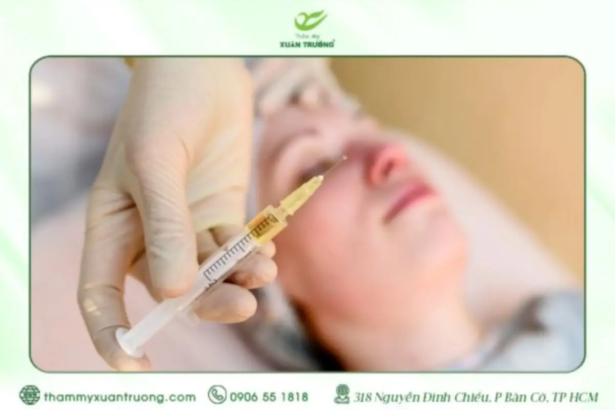 Cấy PRP Bao Lâu Làm Một Lần Để Đạt Hiệu Quả Tối Ưu