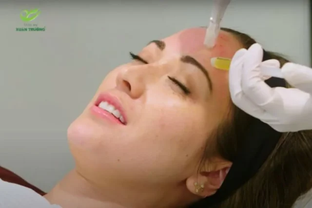 cay PRP gia bao nhieu 2 Lưu ý trước và sau khi cấy PRP để đạt hiệu quả cao