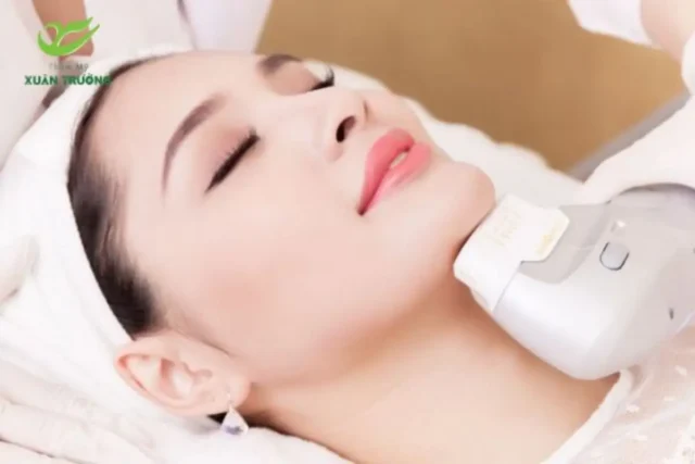 cong nghe HIFU 3 Khách hàng trải nghiệm liệu trình HIFU tại Thẩm Mỹ Xuân Trường