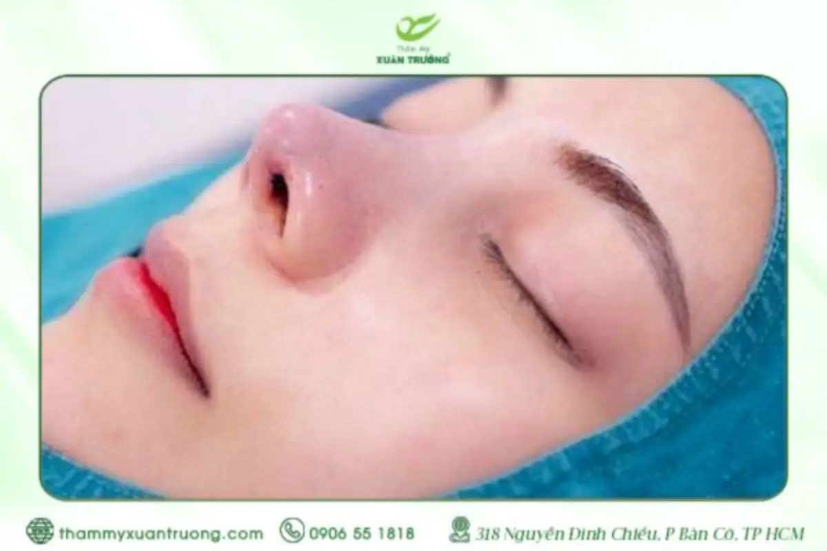Nâng Mũi Cấu Trúc Có Đau Không? Giải Đáp Chi Tiết Từ A → Z