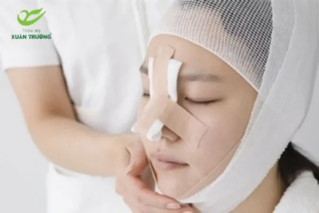 Khách hàng được chăm sóc hậu phẫu sau khi nâng mũi
