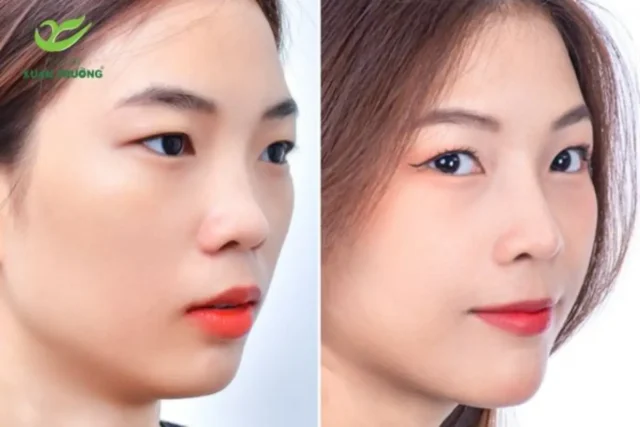 Góc chụp cận mặt làm nổi bật dáng mũi hài hòa