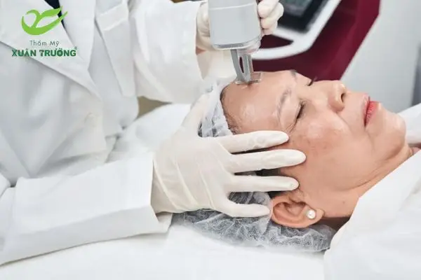 Khách hàng trải nghiệm liệu trình trẻ hóa da trán an toàn, nhẹ nhàng.