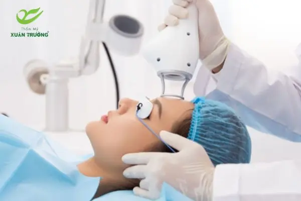 Công nghệ laser trẻ hóa trán mang lại làn da căng mịn tự nhiên