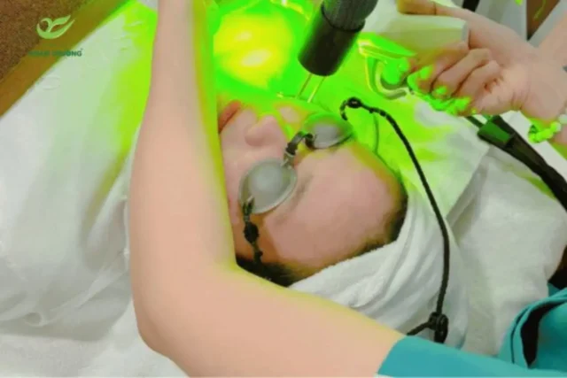 tri mun bang laser 1 Mô phỏng điều trị mụn bằng công nghệ laser