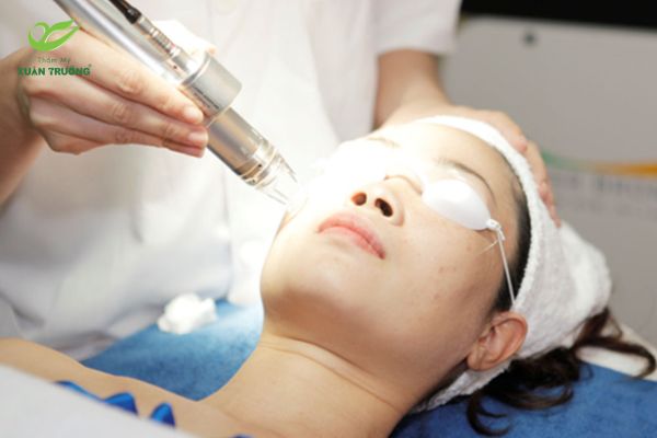 Mô phỏng quá trình trị sẹo rỗ bằng laser tác động trực tiếp lên bề mặt da
