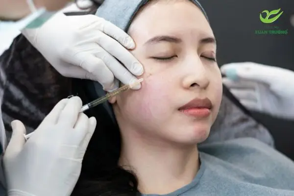Xử lý biến chứng tiêm filler vào mạch máu bằng kỹ thuật y khoa
