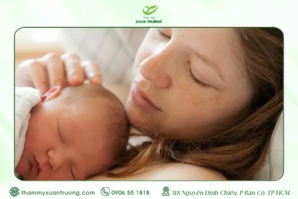Cách Trị Nám Sau Sinh Bằng Nghệ Giúp Làn Da Tươi Sáng