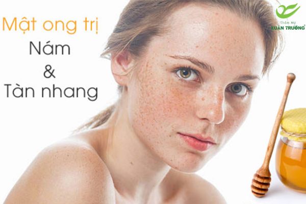 cach tri tan nhang 2 Cách trị tàn nhang bằng mật ong giúp dưỡng ẩm, làm sáng và cải thiện tàn nhang