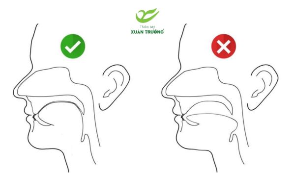 cam lem 3 Tư thế tập Mewing đúng giúp cải thiện cằm lẹm và khuôn mặt