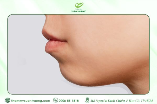 Cằm Lẹm Là Gì? Dấu Hiệu Và Nguyên Nhân Hình Thành