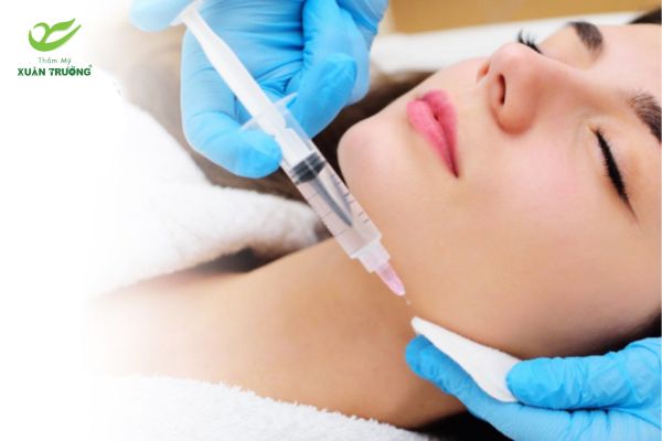 ky thuat tiem filler 2 Kỹ thuật tiêm filler chuẩn y khoa mang lại vẻ đẹp tự nhiên