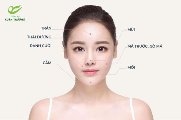 ky thuat tiem filler 3 Phân bố filler đa điểm giúp khuôn mặt mịn màng và cân đối