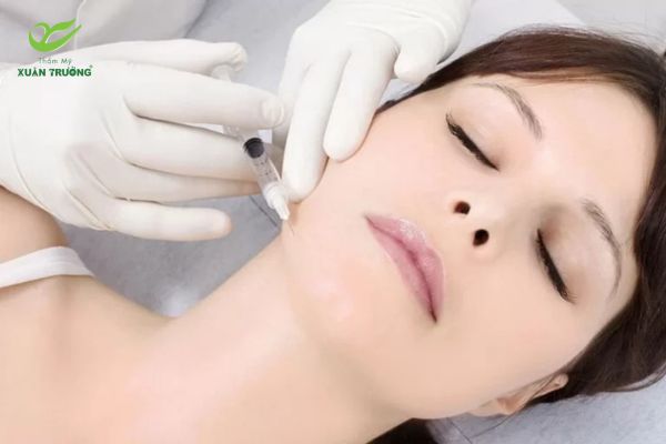 ky thuat tiem filler 4 Tiêm filler đúng kỹ thuật giúp gương mặt hài hòa và cân đối