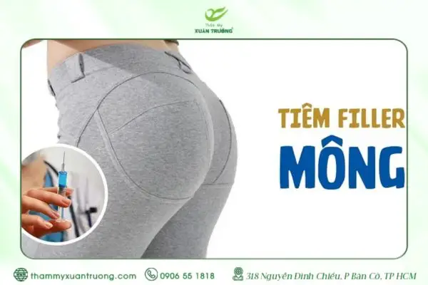 Tiêm Filler Mông Có An Toàn Không? Tìm Hiểu Chi Tiết